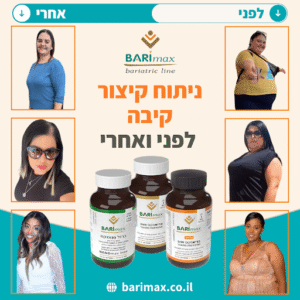 איור המציג את שלבי ניתוח קיצור הקיבה - הכנה לפני הניתוח, התהליך עצמו והתזונה הדרגתית אחרי הניתוח עם מוצרי Barimax
